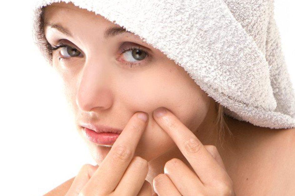 Acne na fase adulta: por que ela ocorre e como lidar com o problema? 
