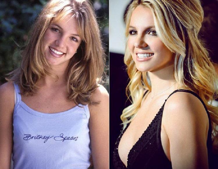 britney spears antes e depois da cirurgia de nariz