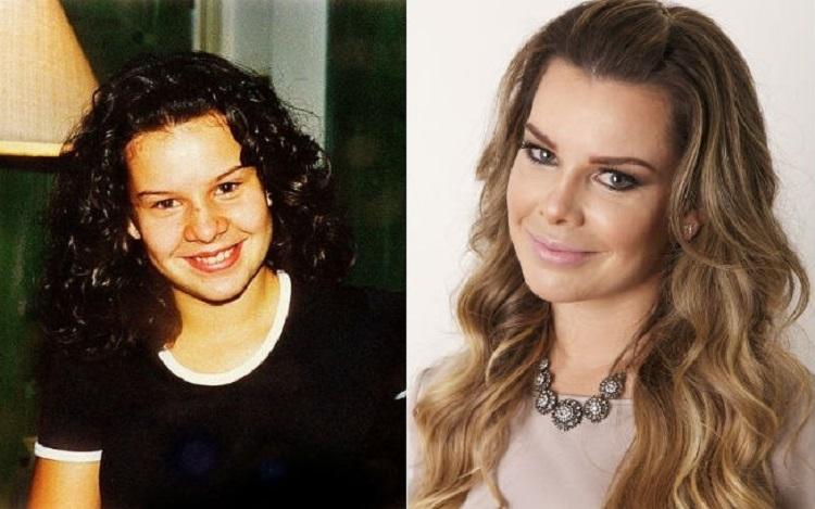 fernanda souza antes e depois da cirurgia do nariz