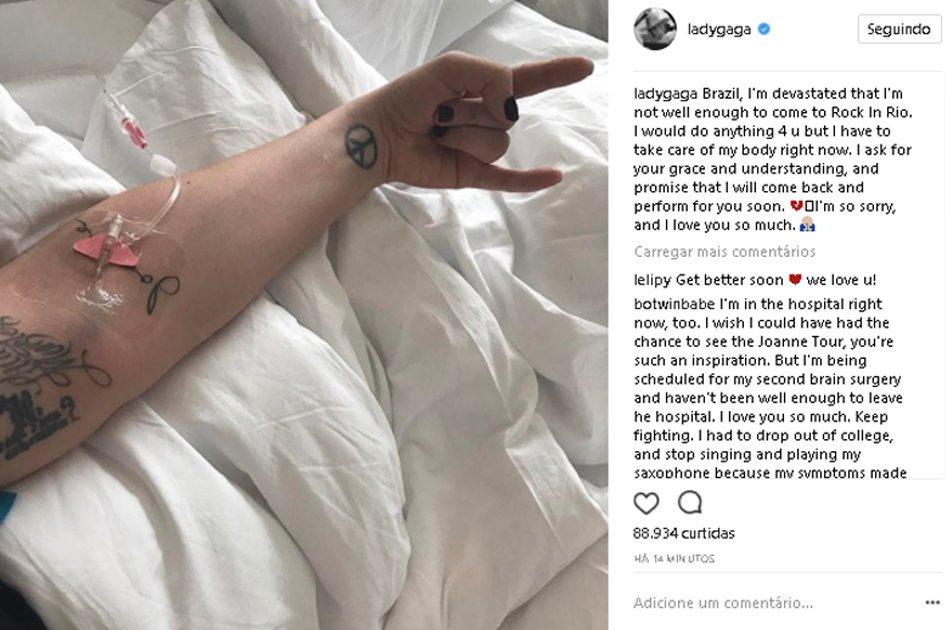 Na foto há o braço da cantora lady gaga em uma foto do instagram