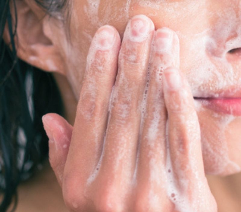 Cicatrizes de acne têm solução, sabia? Veja como tratar