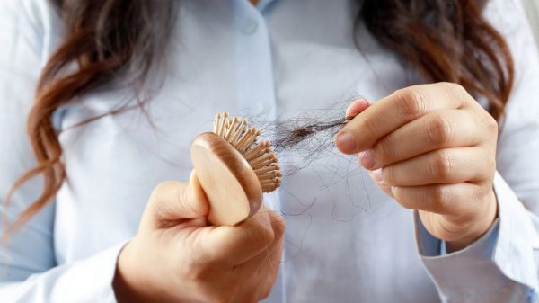 Saiba mais sobre o uso do Minoxidil no tratamento da queda capilar