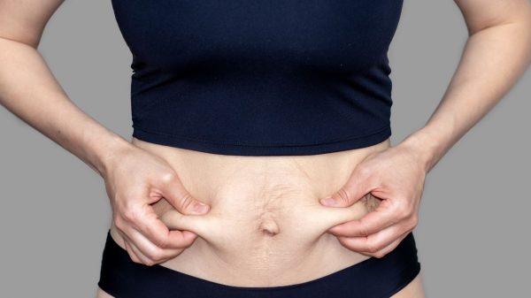 A diástase abdominal provoca uma série de alterações gastrointestinais