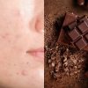 A ideia de que chocolate causa acne pode não ser um completo mito, mas também não é 100% verdade