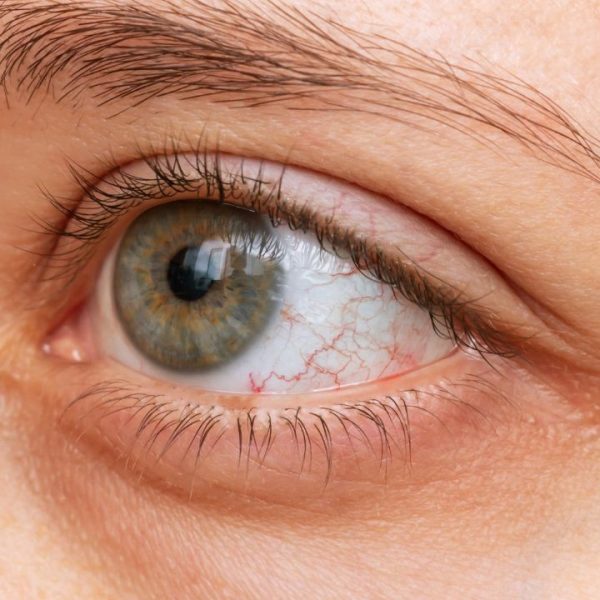 Veja como cuidar dos olhos