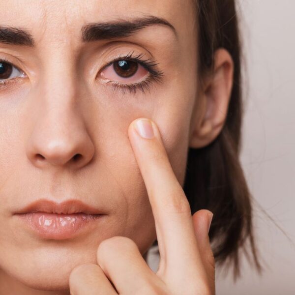 Glaucoma é a principal causa de cegueira irreversível