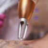 Saiba tudo sobre a remoção de tatuagem a laser