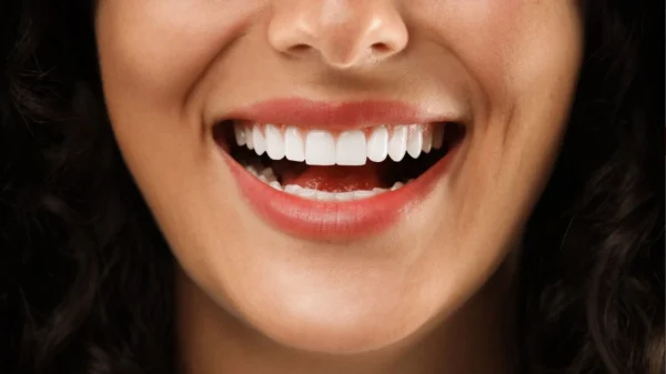 Veja como cuidar dos dentes e dos lábios para ter um sorriso perfeito