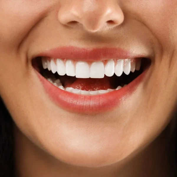 Veja como cuidar dos dentes e dos lábios para ter um sorriso perfeito