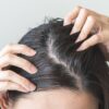 Entenda o que é scalp care e veja dicas de especialistas