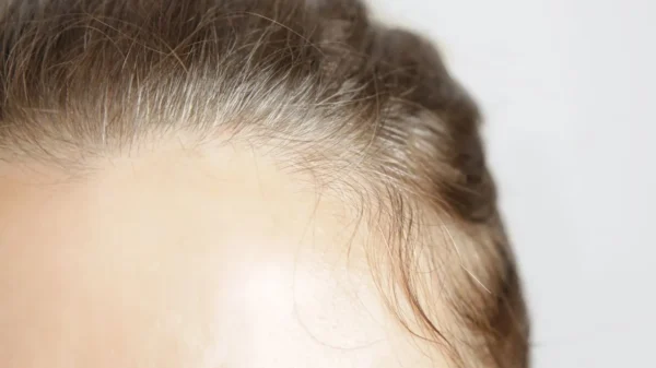 Você sofre com o baby hair? Confira truques para modelá-los e reduzir a ação do frizz no cabelo