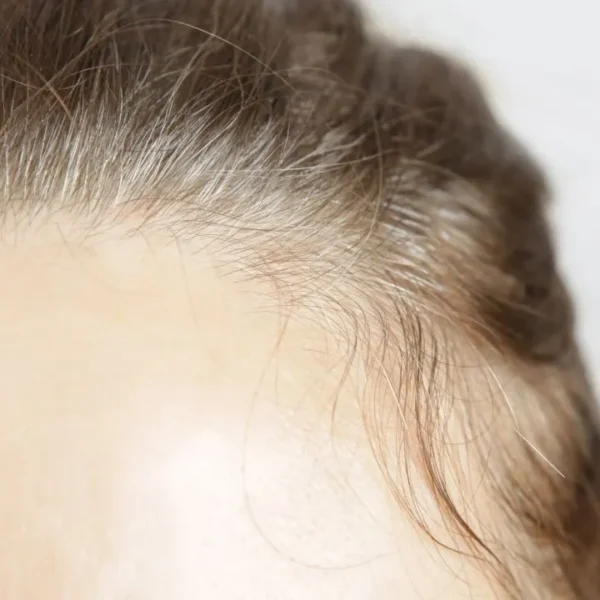 Você sofre com o baby hair? Confira truques para modelá-los e reduzir a ação do frizz no cabelo