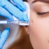 Veja tudo sobre o botox preventivo