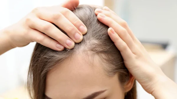 Médica explica como cada técnica funciona e de que forma atuam na saúde do couro cabeludo do paciente com alopecia