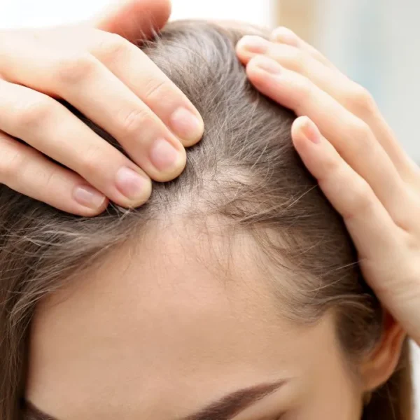 Médica explica como cada técnica funciona e de que forma atuam na saúde do couro cabeludo do paciente com alopecia