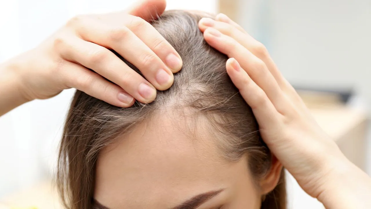 Médica explica como cada técnica funciona e de que forma atuam na saúde do couro cabeludo do paciente com alopecia