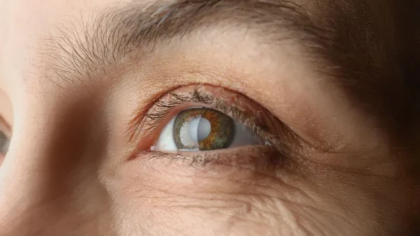O glaucoma é uma doença crônica e silenciosa, que pode causar cegueira irreversível se não for devidamente tratada