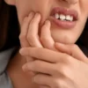 Dentista ressalta os cuidados essenciais para não prejudicar a saúde bucal após quebrar um dente